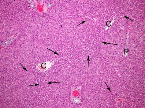 Centrilobular Atrophy Arrows And Periportal Hypertrophy Of Download Scientific Diagram