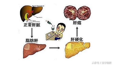 肝脏有解毒、造血和凝血作用，教你日常如何养肝护肝 每日头条