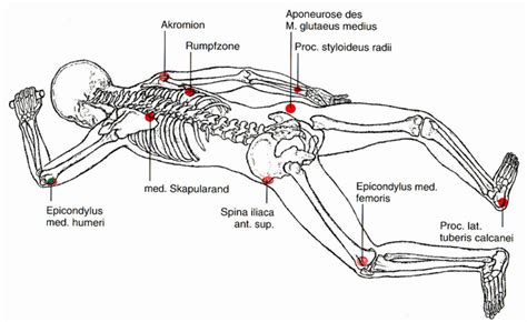 Terapia Vojta Para Personas Con S Ndrome De Down Down Sin Mitos