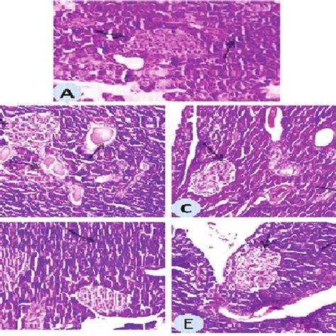 A A Photomicrograph Of Rat Pancreatic Tissue Section Showing Normal