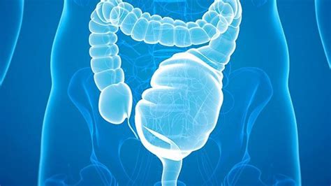 Toxic Megacolon - Causes, Symptoms, and Diagnosis - Maximed