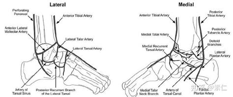 距骨骨折 知乎