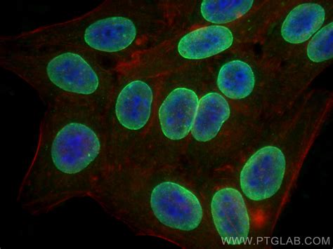 Lamin A C Antibody Ap Proteintech