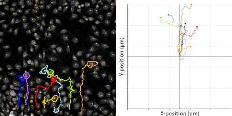 Wound Healing Assay Single Cell Migration Holomonitor