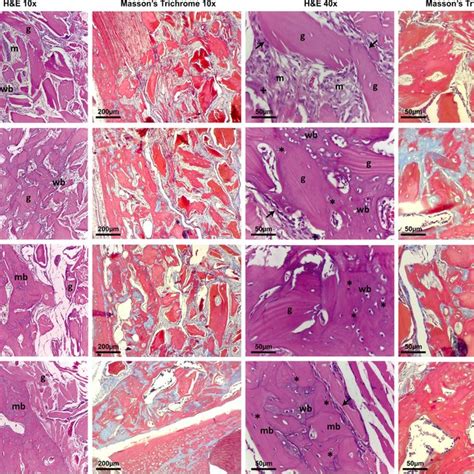 Micro Ct Analysis Demonstrated A Higher Volume Of New Bone Formation