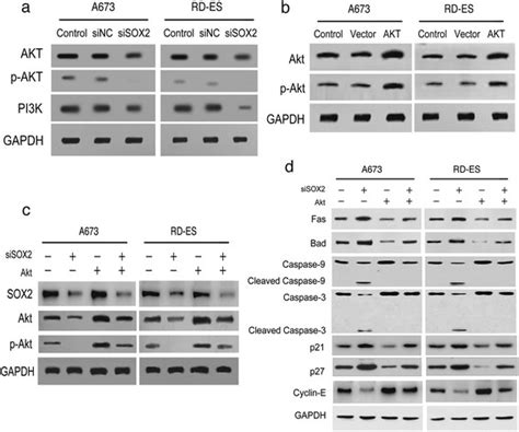 Sox2 Was Found To Regulate Cell Cycle And Apoptosis Of Ewings Sarcoma