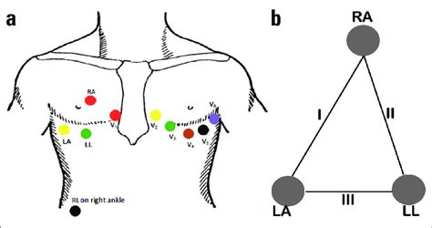 A Placement Of Modified Limb Electrodes On The Torso The Precordial