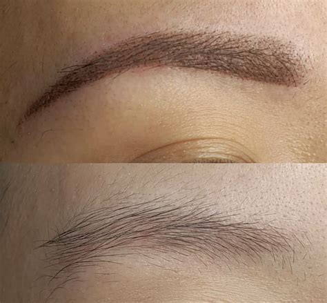 Eyebrow Tattooing Pros Cons Costs Alternatives Wimpole Clinic