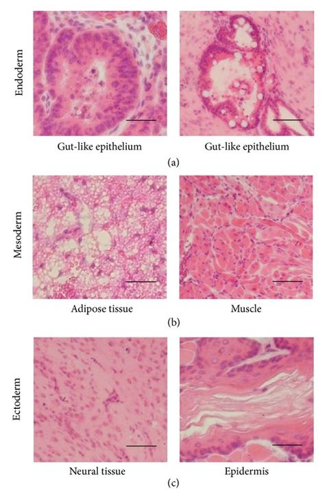 Histological Analysis Of Teratoma Formation After Transplantation Of