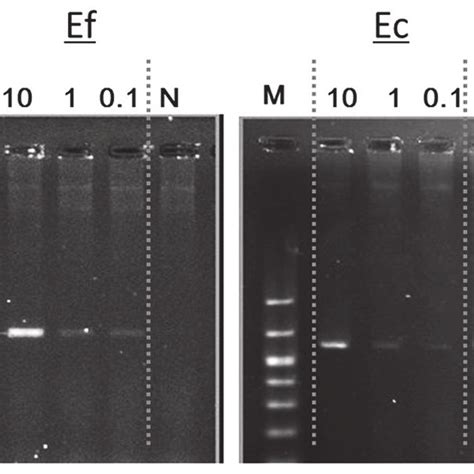 Amplification Of The 16s Rrna Gene Using Bacterial Genomic Dna Samples Download Scientific