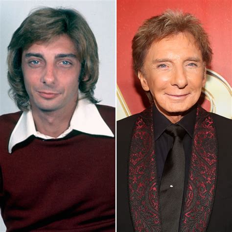 Barry Manilow Plastic Surgery A Possible Facelift Nose Job And