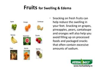 Foods to Eat in Swelling & Edema | PPT