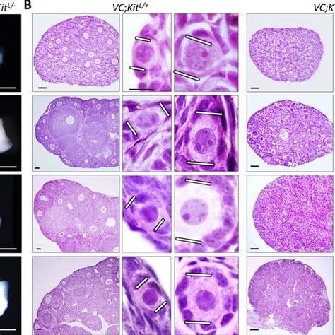 Stages Of Follicular Maturation Mouse Follicles Are Depicted Not To