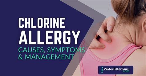 Chlorine Allergy Causes Symptoms And Management