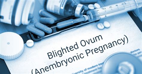 Anembryonic Pregnancy And A Blighted Ovum Facty Health