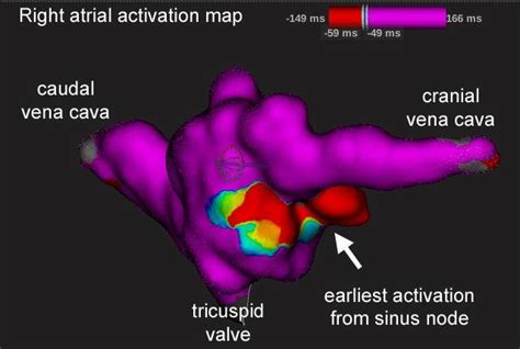 D Electroanatomical Intracardiac Mapping Of The Right Atrium In An