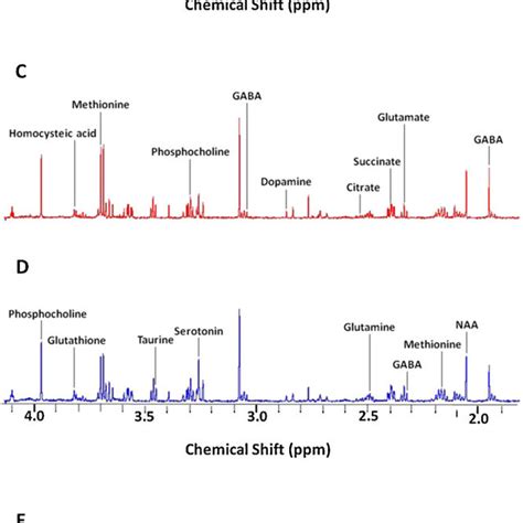 Typical 600 MHz CPMG 1 H NMR Spectra Of The Brain Tissue Extracts From