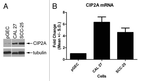 Cip2a Expression And Localization In Oral Carcinoma And Dysplasia