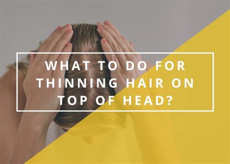 What To Do For Thinning Hair On Top Of Head