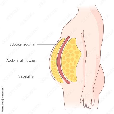 Layers Of Subcutaneous And Visceral Fat In The Human Abdomen Abdominal