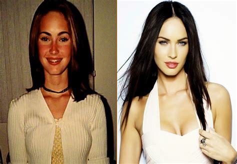 10 Popular Celebrities Before and After | Top 10s