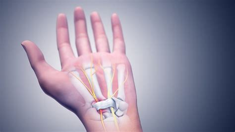 What Causes Cramps In Hands and Fingers? - CureMyCramp.com