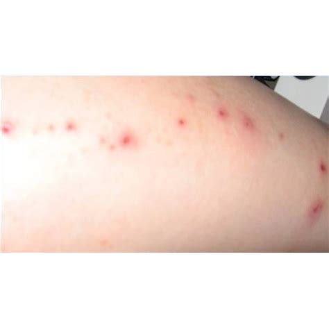 How To Diagnose A Skin Rash Healthfully