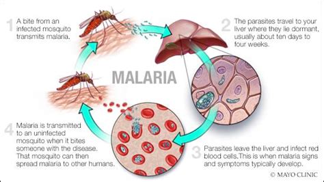 Malaria Symptoms Causes Mayo Clinic