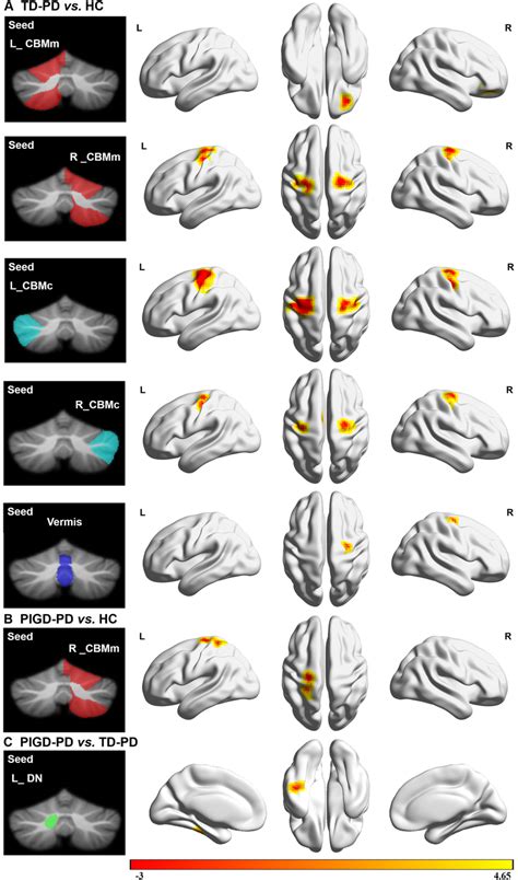 Functional Connectivity Fc Differences Of The Cerebellar Seeds Download Scientific Diagram