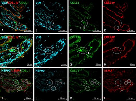 Type I Collagen Intracellular Staining In Ierm A D Type I Collagen