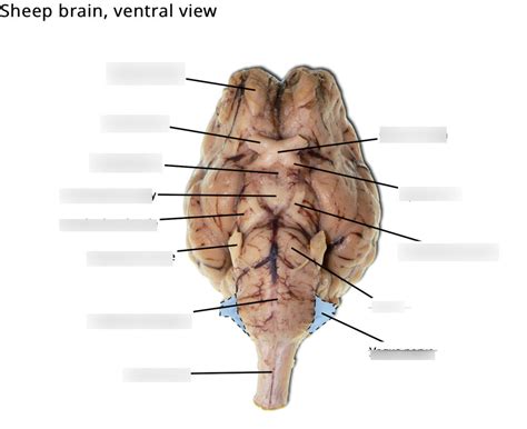 Sheep Brain Diagram Quizlet