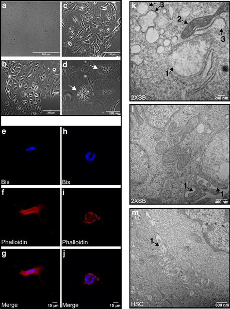 The Morphology Of The 2xsb Sporadic Mpnst Cell Line Recapitulates The Download Scientific