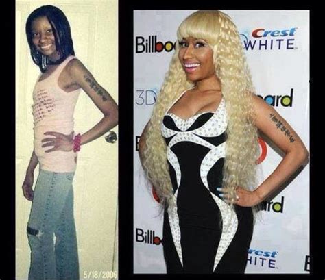 Exploring Nicki Minaj The Iconic Transformation Before Surgery