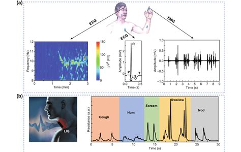 A Eeg Ecg And Emg Measurements Adapted With The Permission From Ref Download Scientific