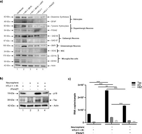 HTLV 1 Co Culture And Expression Of Cellular Markers In HIV 1 And