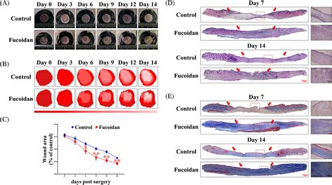 Fucoidan Promotes Angiogenesis And Accelerates Wound Healing Through