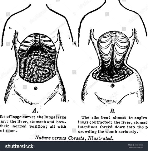 Nature Versus Corsets A Woman S Internal Anatomy Contrasted With The Corset S Effects On The