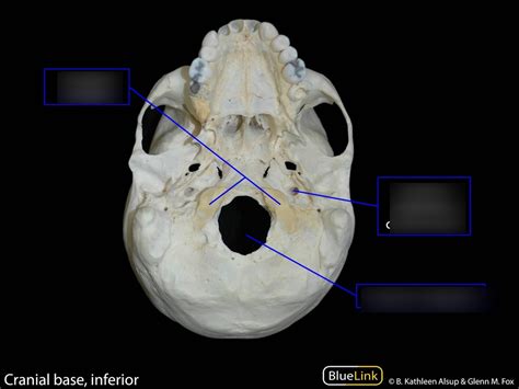 Cranium Inferior View Diagram Quizlet