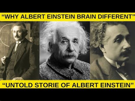 Why Albert Einstein Brain Different To Others Untold Story Of Albert