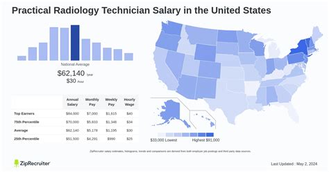 Radiology Technician Salary