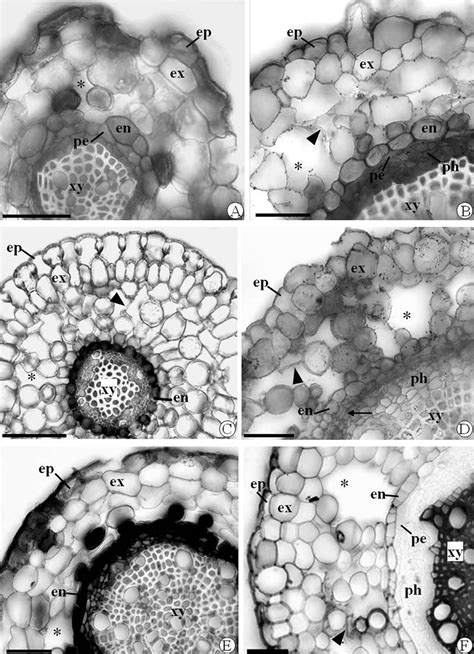 Root cross section in primary growth stage. (A and B) Lavoisiera ...