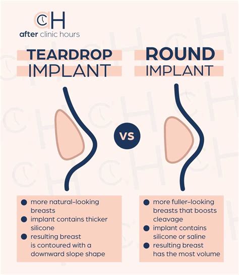 Types Of Breast Implants Artofit