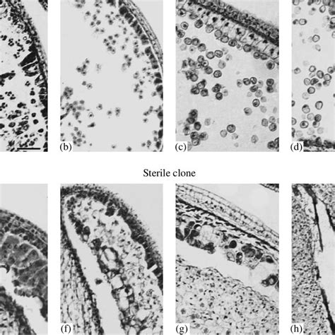 Correlation Between The Length Of The Buds And The Stages Of The Anther Download Scientific