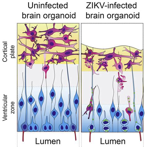 Recent Zika Virus Isolates Induce Premature Differentiation Of Neural