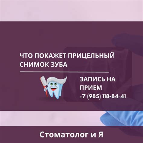 Что покажет прицельный снимок зуба