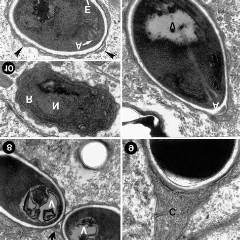 Diagram Of The Mature Spore Of Microsporidium Epithelialis Sp N