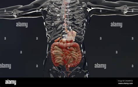 Man Suffering From Crohns Disease Male Anatomy Inflamed Large