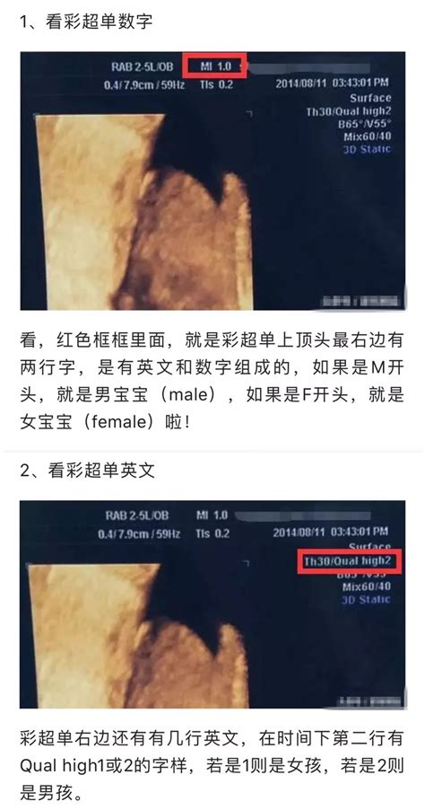 孕检b超单有这个一般是女孩（天呐！b超只要看一个数字就能知道胎宝性别？） 说明书网