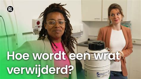 Hoe Wordt Een Wrat Verwijderd Vragen Van Kinderen YouTube