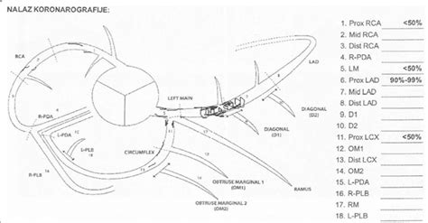 Scheme of coronary angiogram showed stenosis of coronary arteries ...